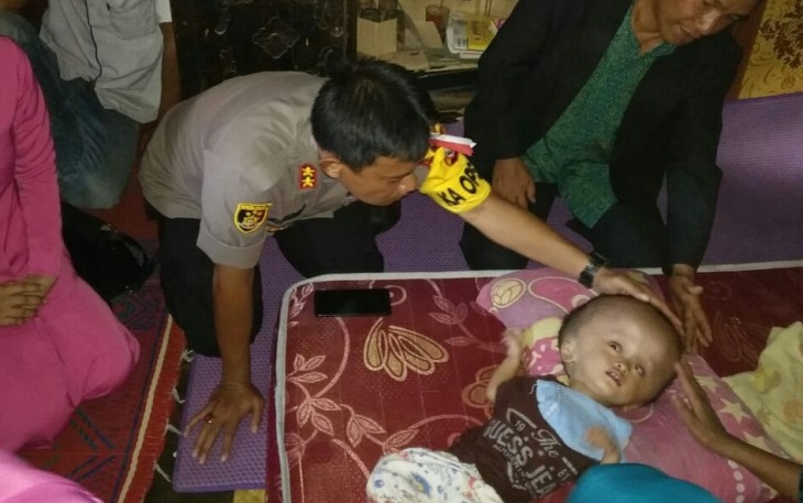 Kapolres Kaur saat mengunjungi balita penderita hidrosefalus