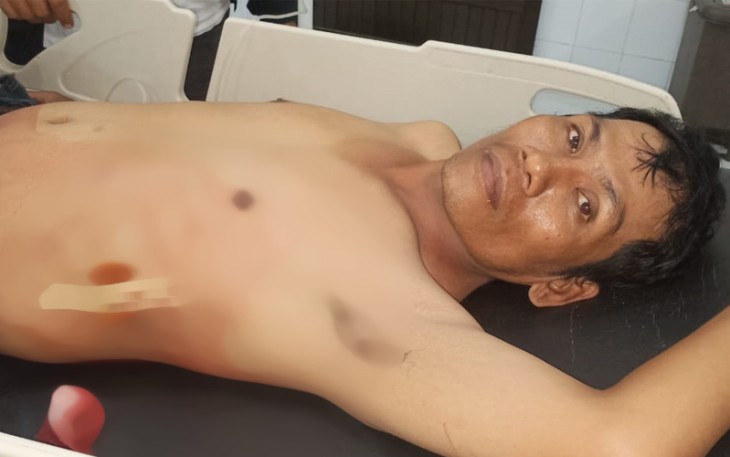Korban usai mendapat perawatan medis di Rumah Sakit Umum HAMS Kisaran