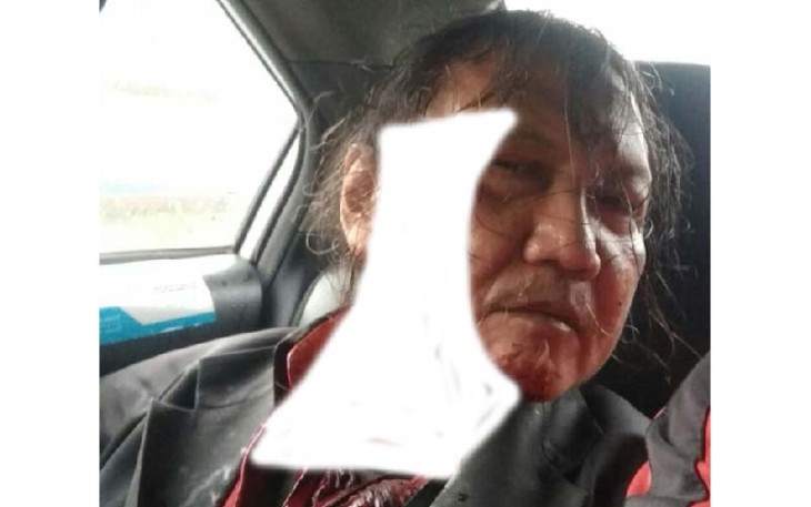 Korban Penganiayaan Kosasih Alias Romo Merupakan Seorang Wartawan 