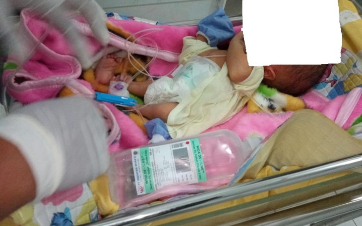 Perjuangan Bayi Arga Untuk Sembuh Dari Penyakit Hydrochephalus dan Spina Bifida