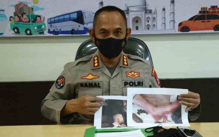 Kombes Pol Drs Ahmad Musthofa Kemal membenarkan anggota TNI Polri tertembak KKB saat conference pers di Jayapura. Senin (02/05/2022)