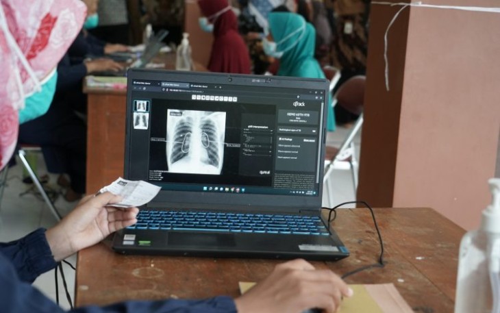 Kenali Kelompok yang Berisiko Tinggi Tertular TBC