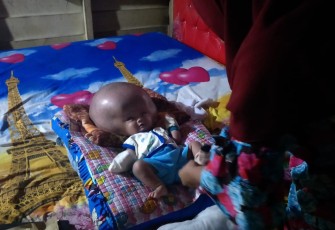 Rehan Saputra Bayi 5 Bulan Penderita Hidrosefalus Butuh Uluran Tangan Dermawan
