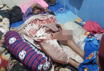 Anang Fitriansyah, remaja penderita kanker tulang, warga Ngargoyoso, Karanganyar