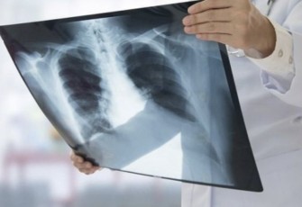 Ilustrasi Foto Rontgen 