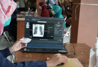 Kenali Kelompok yang Berisiko Tinggi Tertular TBC
