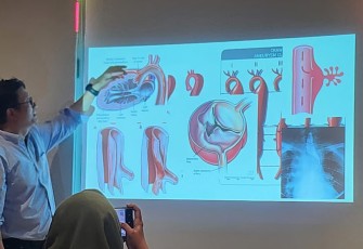 Kecepatan Menjadi Kunci Penyelamatan Nyawa pada Penanganan Penyakit Aorta Kompleks di Era Modern