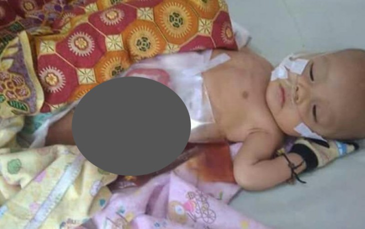 Muhammad Iksan Sayuti Putyra, balita laki-laki usia 4 bulan yang terlahir dengan kondisi kurang beruntung