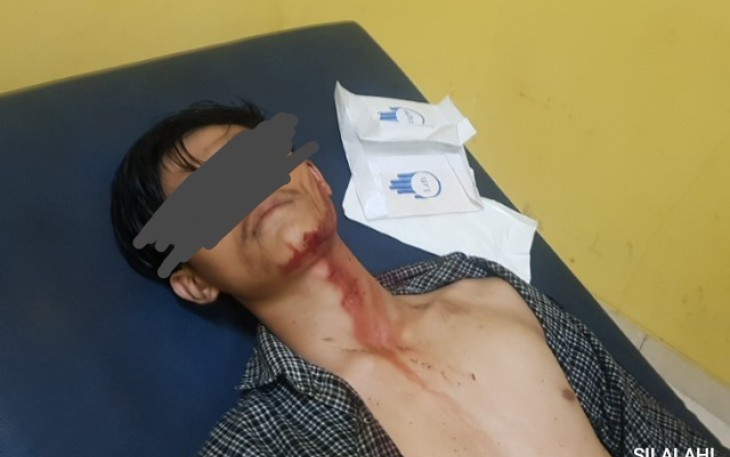 CekCok Mulut, Pemuda 19 Tahun Jadi Korban Penusukan