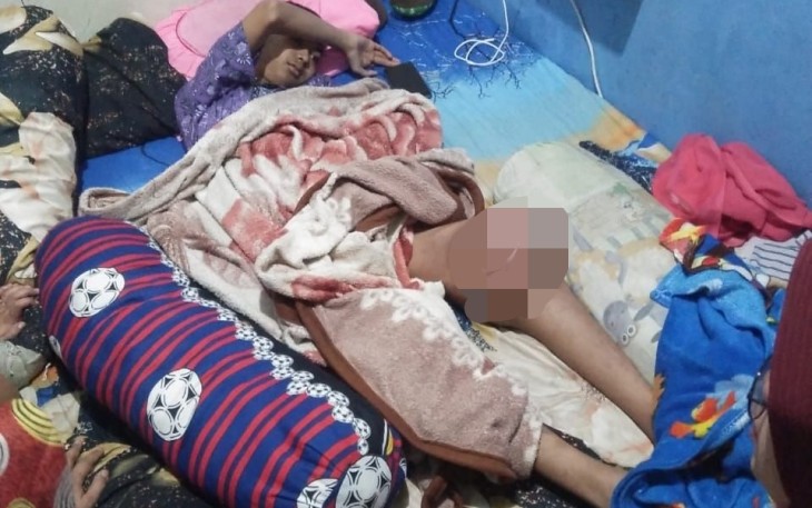 Anang Fitriansyah, remaja penderita kanker tulang, warga Ngargoyoso, Karanganyar