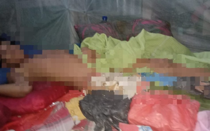 Korban Penganiayaan terbaring dirumahnya akibat mengalami pinggul bergeser dan patah tulang paha dianiaya oleh seseorang.