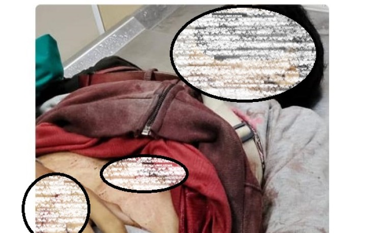 Aksi Tawuran yang Sebabkan Seorang Pelajar Meninggal Dunia