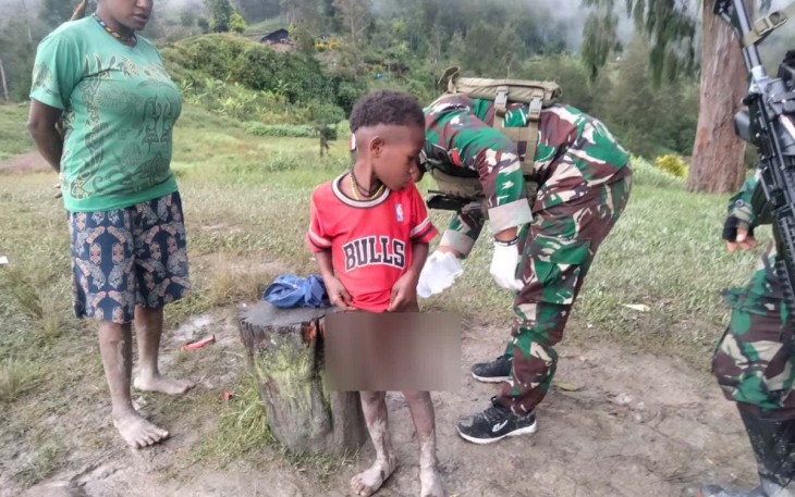 Obati penyakit kulit anak-anak Papua