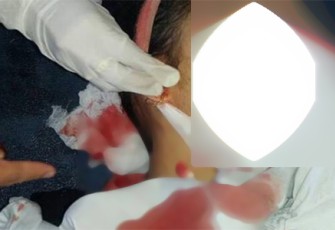 Korban tewas meski sempat dirawat di RSUD Hasanuddin Damrah