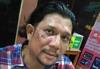 korban penganiayaan (Ketua SMSI Kabupaten Mandailingnatal (Madina) Jeffry Barata Lubis)
