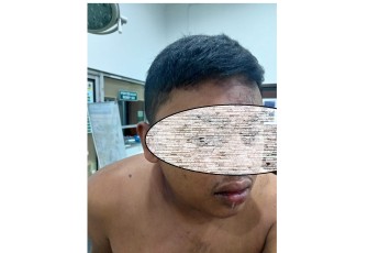 Terduga Pelaku Diamankan        